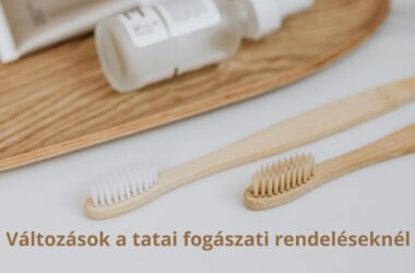 Kiemelt kép a Változás fogorvosi körzetekben című bejegyzéshez